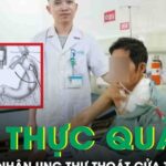 Người đàn ông phải cắt thực quản để điều trị ung thư