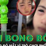Chơi bong bóng xà phòng, bé gái 5 tuổi sưng đỏ 2 mắt phải cấp cứu khẩn