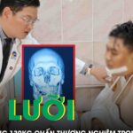 Cứu chàng trai nặng 130 kg đứt lưỡi sau tai nạn giao thông