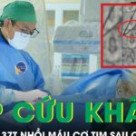 Sau cuộc nhậu, người đàn 37 tuổi bất ngờ lên cơn nhồi máu cơ tim phải cấp cứu khẩn