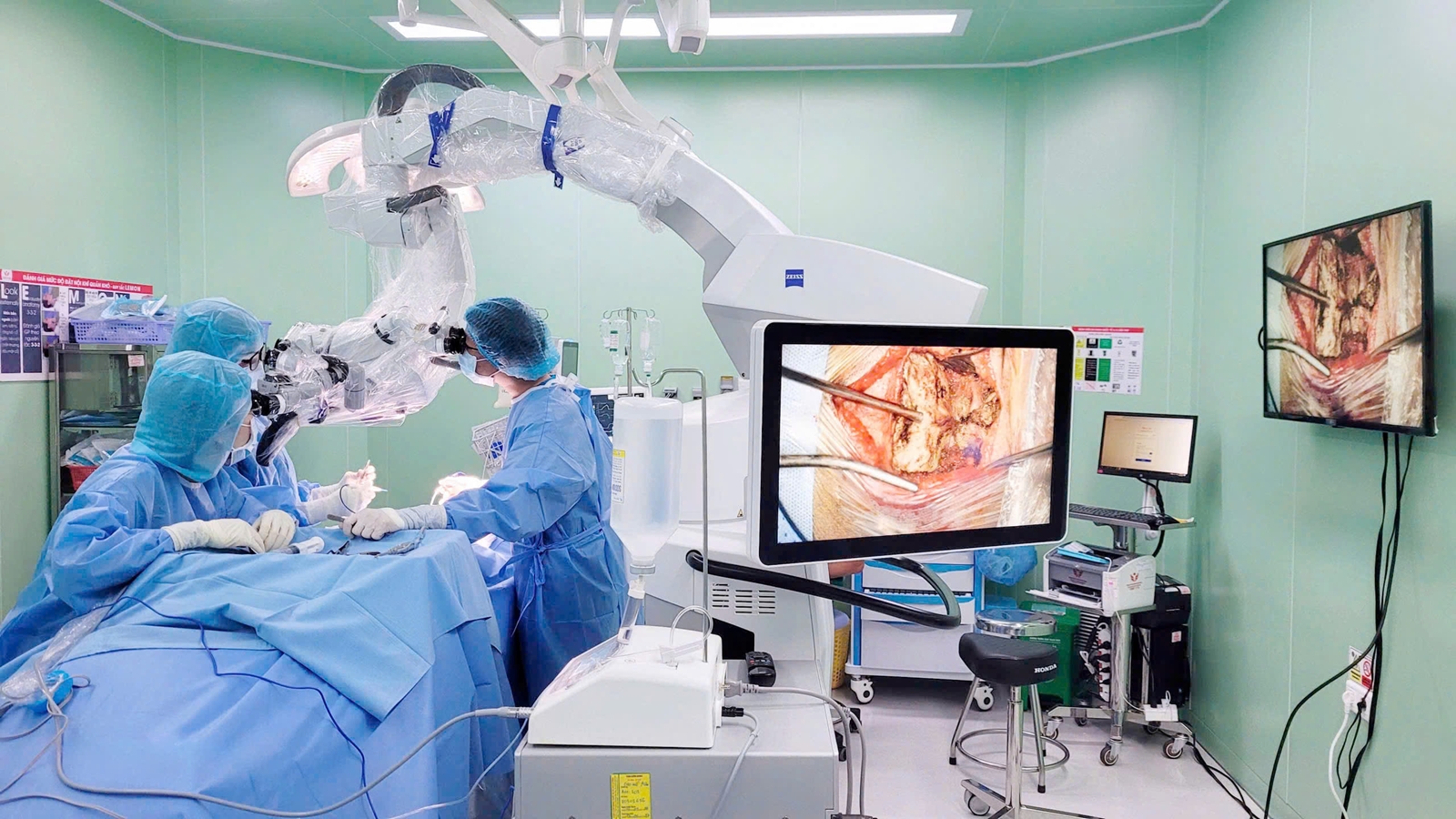 Cứu sống cụ bà 86 tuổi bị túi phình động mạch não nhờ phẫu thuật lỗ khóa- Ảnh 1. Cứu sống cụ bà 86 tuổi bị túi phình động mạch não nhờ phẫu thuật lỗ khóa- Ảnh 1.