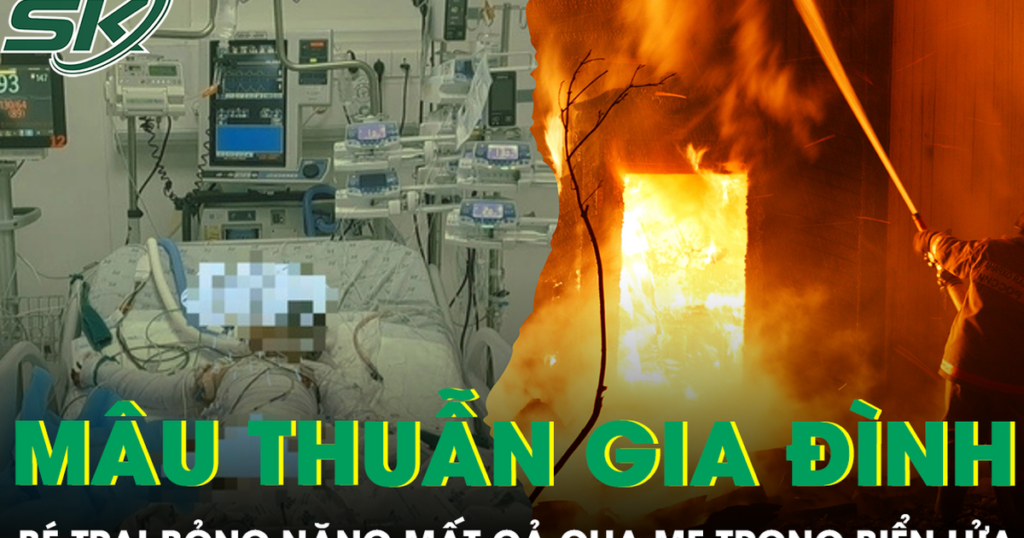 Căn nhà chìm trong biển lửa sau mâu thuẫn gia đình, bé 4 tuổi bỏng hơn 90% cơ thể