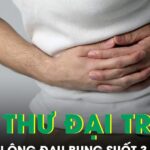 Đau bụng suốt 3 tháng người đàn ông phát hiện ung thư đại trực tràng