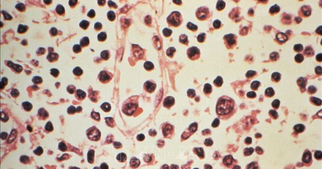 Đài Loan (Trung Quốc) ghi nhận 1 ca tử vong do nhiễm virus Hanta