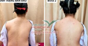 Tìm hiểu nguyên lý ‘Khai thông cột sống’ của Lão Nhà Quê