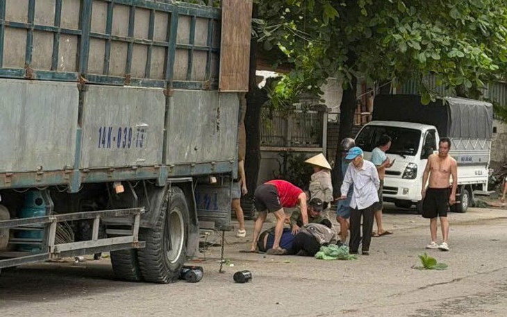 Vi phẫu cứu bàn tay gần đứt rời do tai nạn nổ bình khí nén
- Ảnh 3.