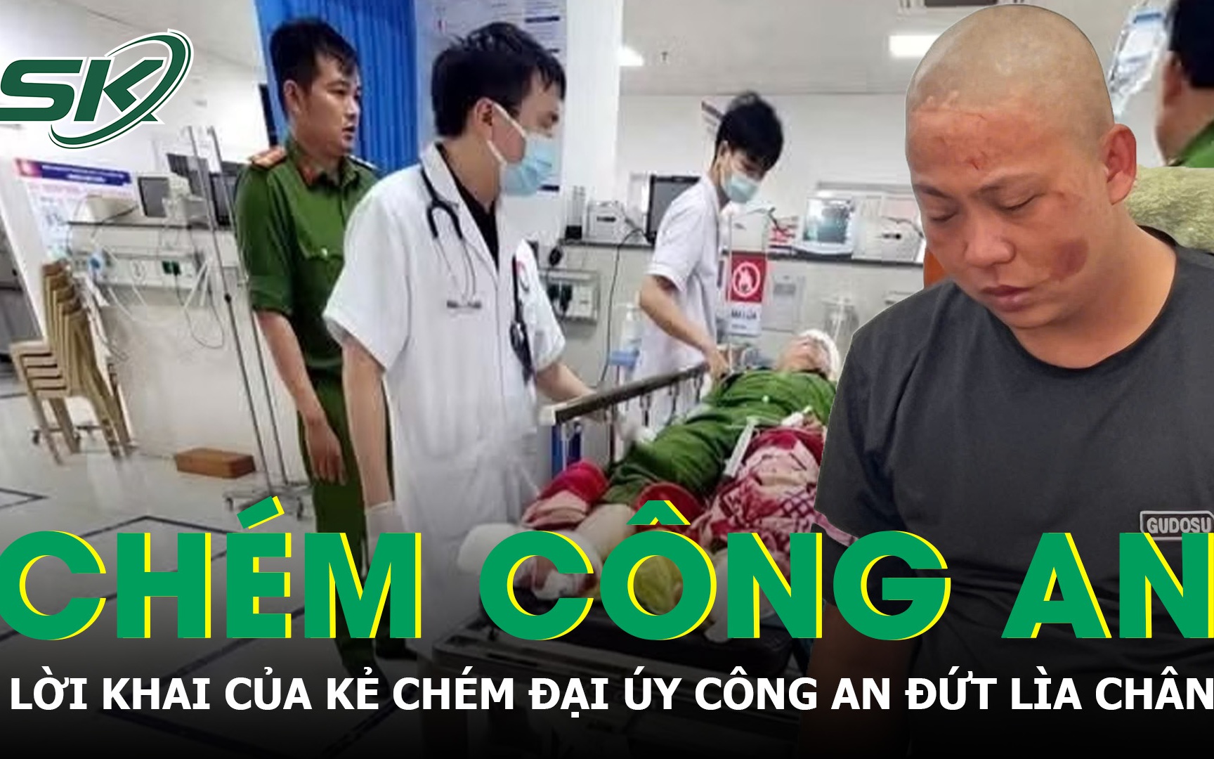 Người đàn ông suýt mất chân vì máy cắt rạ, làm gì để giữ cơ hội phục hồi chi thể?- Ảnh 3.