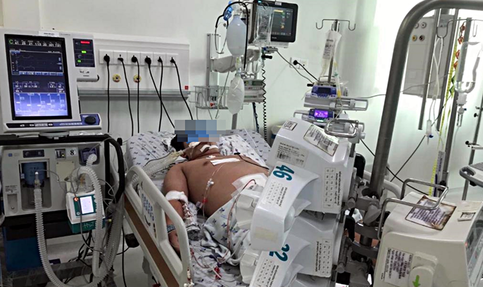 ndtp-sxh-1778291174041584568538 Đầu mùa mưa, nhiều giải pháp được triển khai nhằm giảm số ca sốt xuất huyết nặng- Ảnh 3.