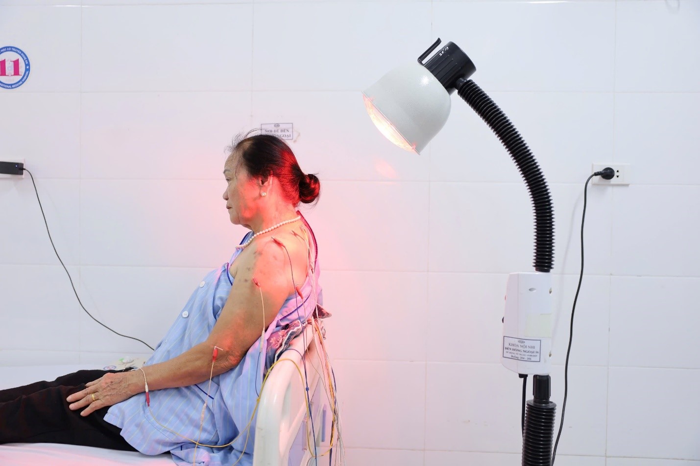 picture3-1778229543229488546520 Đau kéo dài sau Zona: Biến chứng không nên xem nhẹ- Ảnh 3.