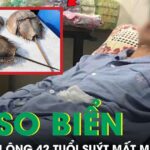Người đàn ông 42 tuổi suýt mất mạng do ăn so biển