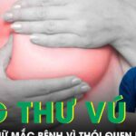 Nhiều phụ nữ mắc ung thư vú vì những thói quen phổ biến này