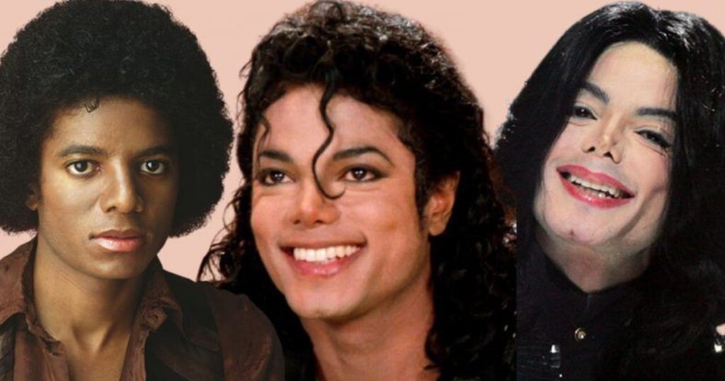 Sự thật về căn bệnh hiếm khiến Michael Jackson phải tẩy trắng da