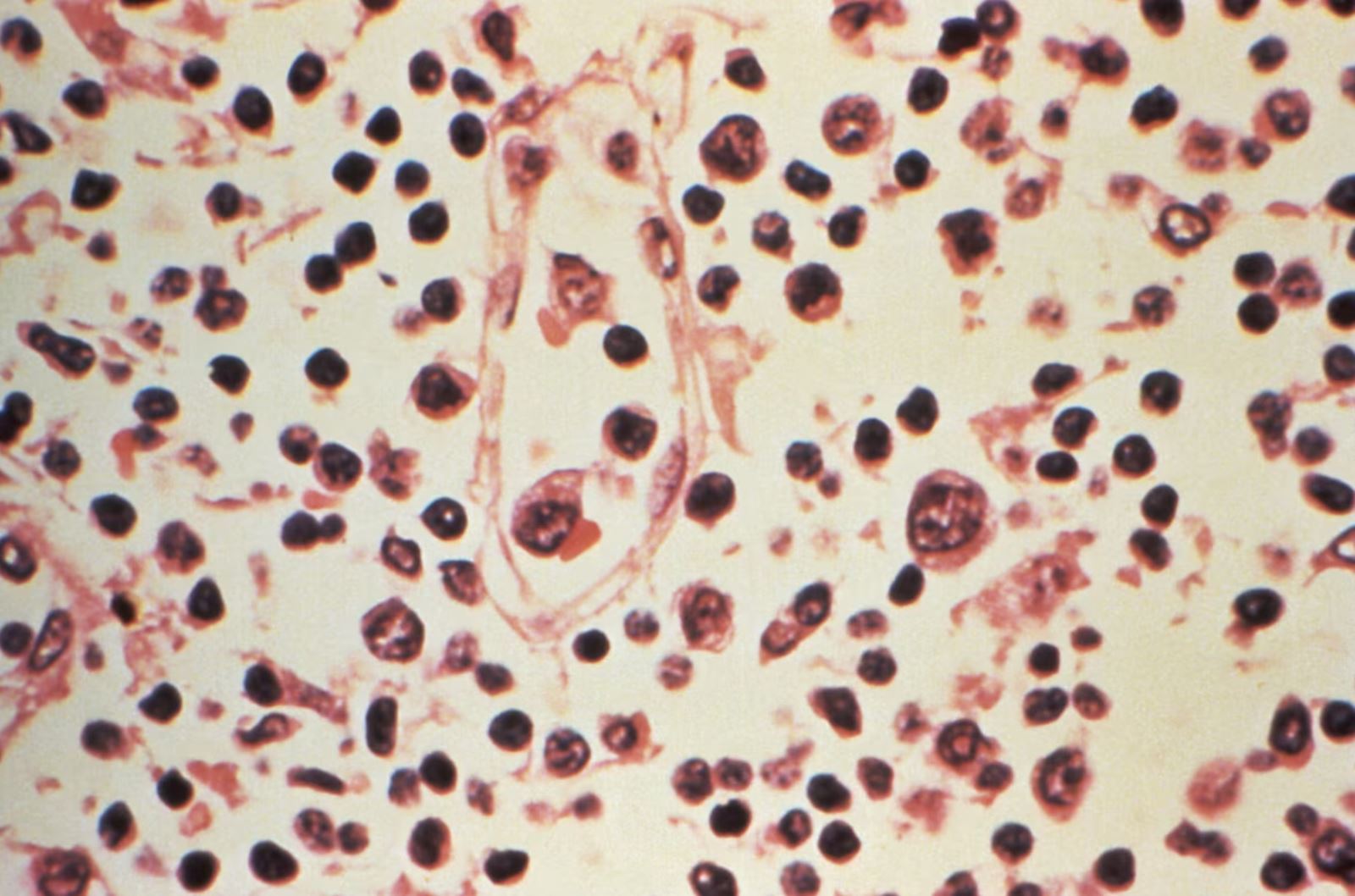Thách thức trong cuộc đua phát triển vaccine phòng virus Hanta- Ảnh 2.