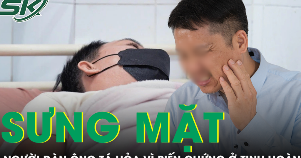 Tá hỏa vì tinh hoàn gặp biến chứng do chủ quan với dấu hiệu sưng mặt