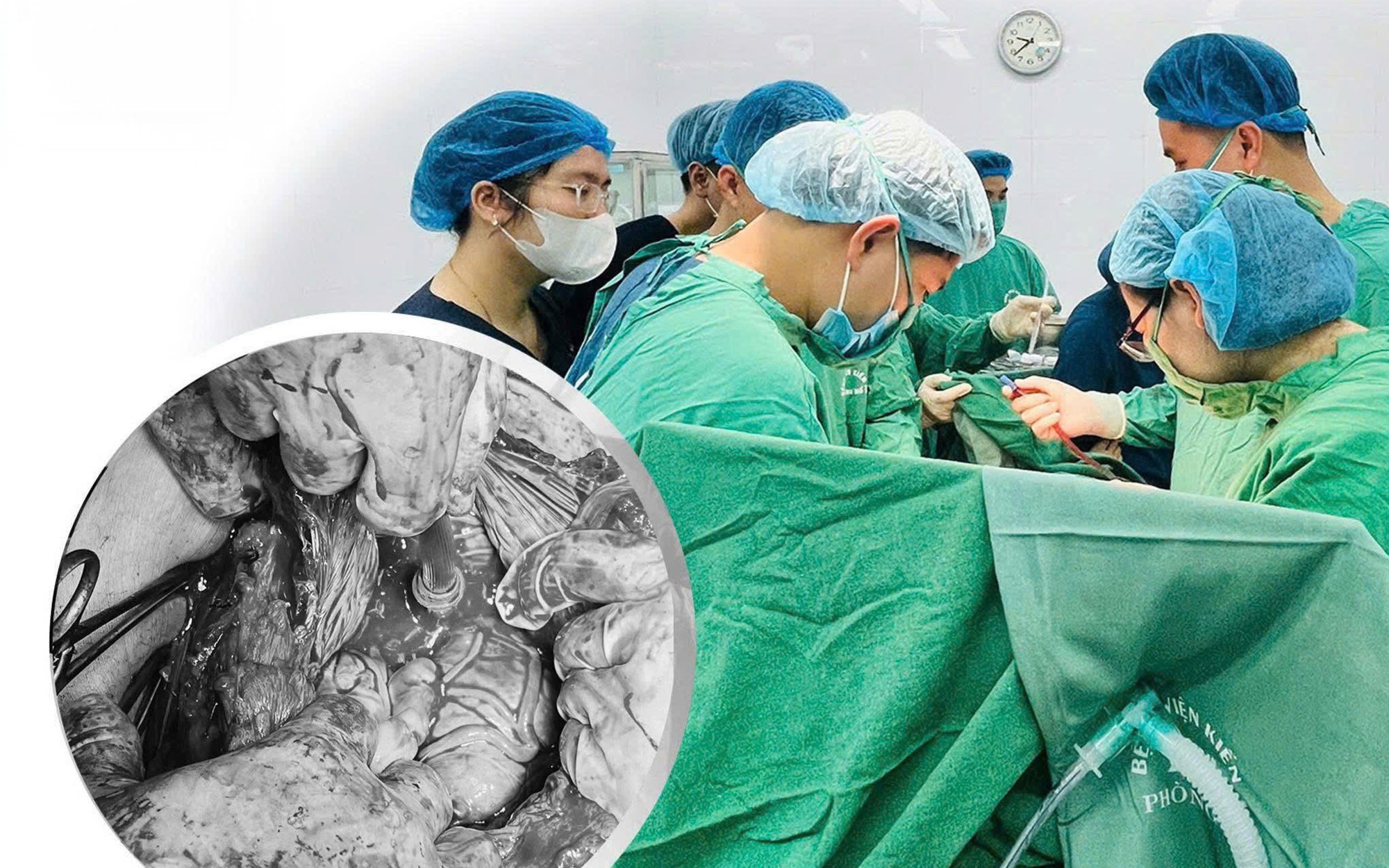 Nghẹt thở giành giật sự sống cho sản phụ chấn thương sọ não cùng thai nhi 36 tuần - Ảnh 2.