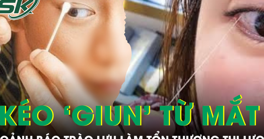Rộ trào lưu kéo ‘giun’ từ mắt để thải độc gây nguy cơ tổn thương thị lực