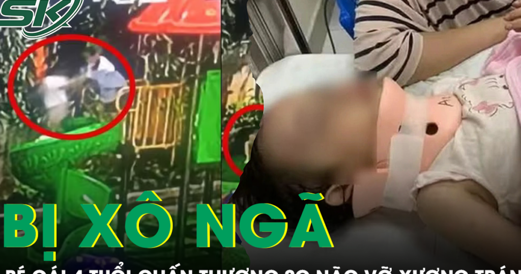 Bé gái 4 tuổi bị bạn xô ngã từ cầu trượt cao 1,5m chấn thương sọ não vỡ xương trán