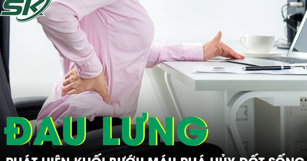 Đau lưng kéo dài, người phụ nữ phát hiện khối bướu máu đã phá hủy gần toàn bộ đốt sống