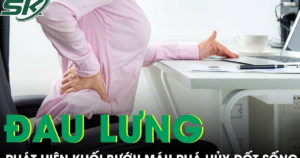Đau lưng kéo dài, người phụ nữ phát hiện khối bướu máu đã phá hủy gần toàn bộ đốt sống