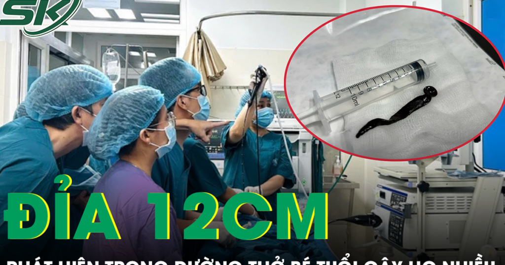 Bé 8 tuổi ho nhiều, bác sĩ phát hiện con đỉa dài hơn 12 cm trong đường thở