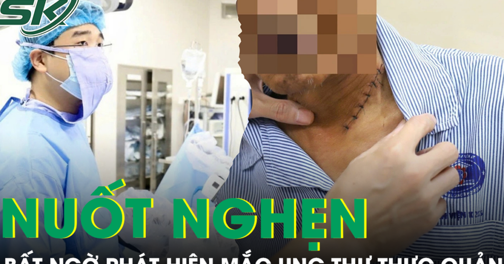 Nuốt nghẹn khi ăn, không ngờ phát hiện mắc ung thư thực quản xâm lấn nguy hiểm