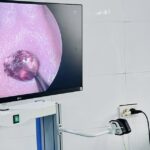 Đau nhức tai suốt một tuần, người phụ nữ tá hỏa vì ‘vị khách lạ’ trong tai