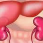 Nhận biết dấu hiệu bệnh trở nặng của xơ gan