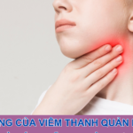 Ảnh hưởng của viêm thanh quản mạn tính và cách hỗ trợ cải thiện