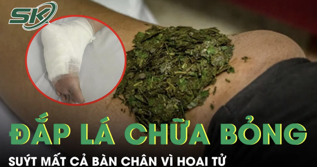 Đắp lá chữa bỏng, người đàn ông tiểu đường suýt mất cả bàn chân