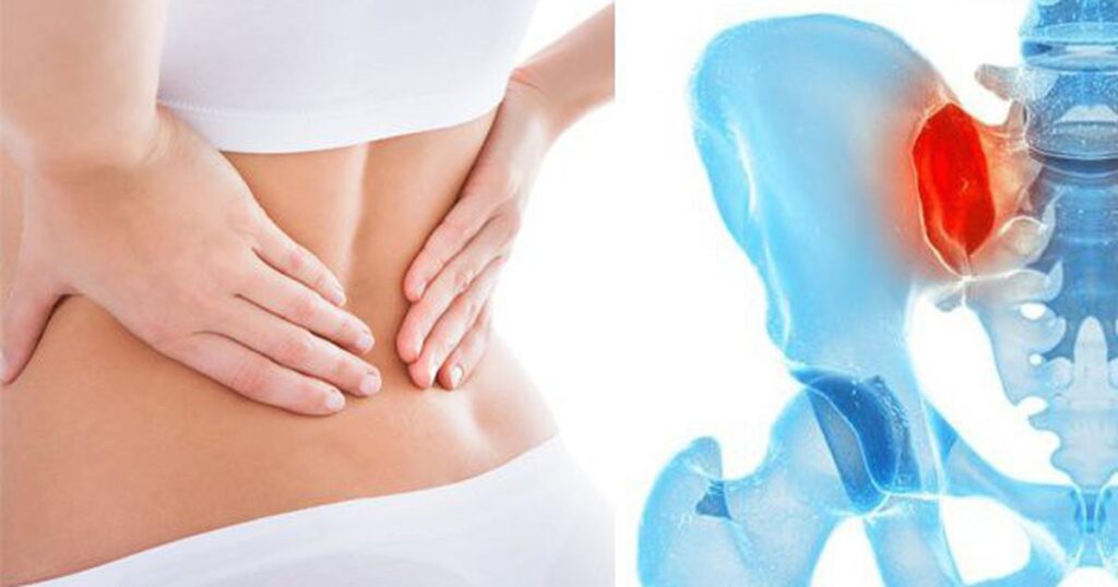Đau vùng chậu mạn tính do đâu?