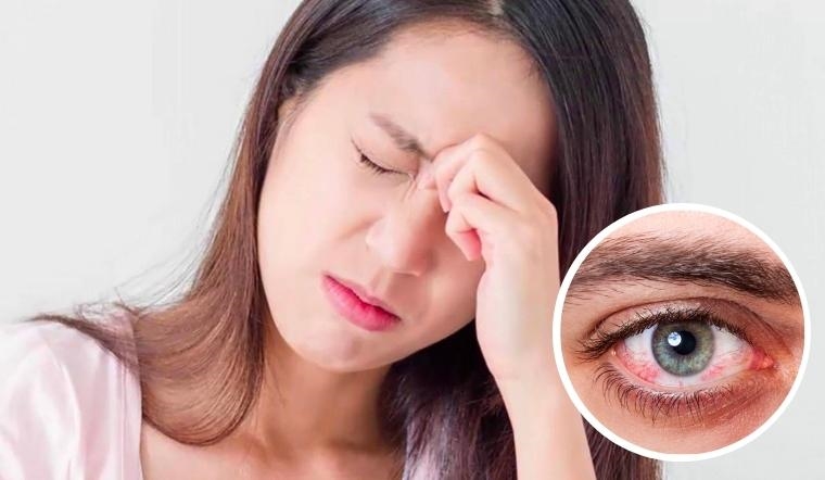 Đau hốc mắt cảnh báo bệnh gì?- Ảnh 2.