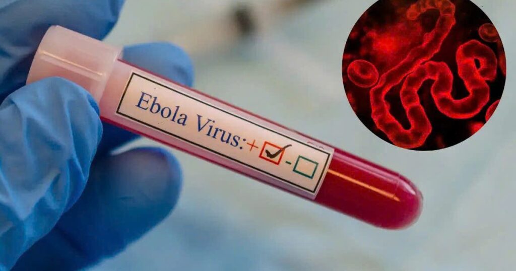 Dịch bệnh Ebola diễn biến phức tạp tại Châu Phi nhưng người dân không nên hoang mang