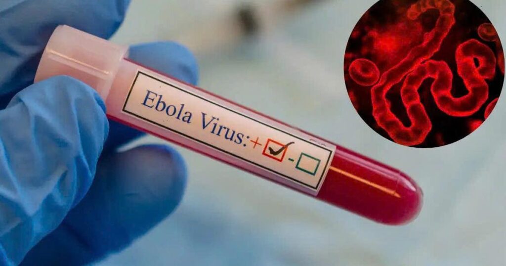 WHO cảnh báo khẩn về Ebola, Bộ Y tế yêu cầu tăng cường giám sát, ngăn dịch xâm nhập