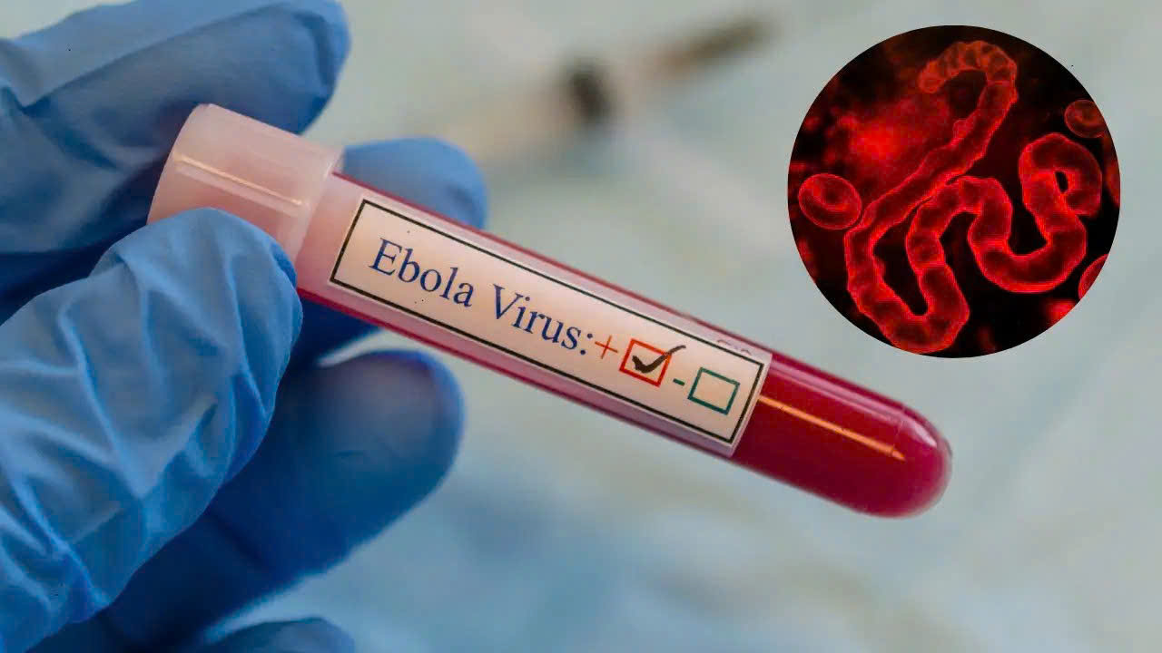 Dịch bệnh Ebola diễn biến phức tạp tại Châu Phi nhưng người dân không nên hoang mang- Ảnh 1.