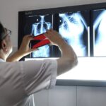 Dấu hiệu nhiều phụ huynh bỏ qua khiến trẻ biến dạng cột sống