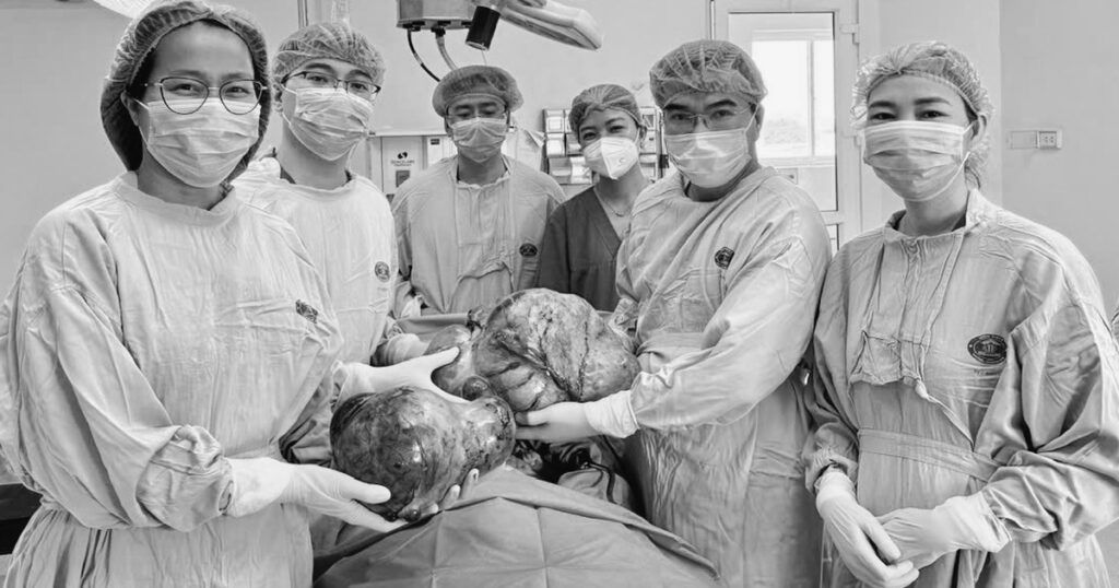 Phẫu thuật thành công khối u buồng trứng nặng gần 15kg cho nữ sinh 16 tuổi