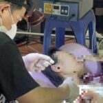 Vụ ông Nguyễn Tiến Nam: Bác sĩ nói gì về việc tự ý mổ u bằng dao điện cao tần?