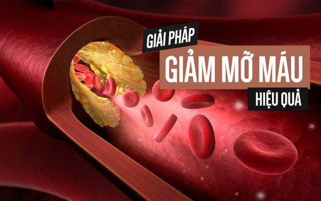 mo-mau-cao-17750182385211123409048-0-6-409-660-crop-17750186708889441152 Thực phẩm tốt cho người mỡ máu cao