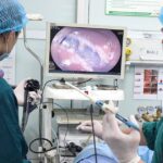 Cứ nghĩ bị trĩ, người phụ nữ bất ngờ phát hiện khối polyp lớn trong trực tràng