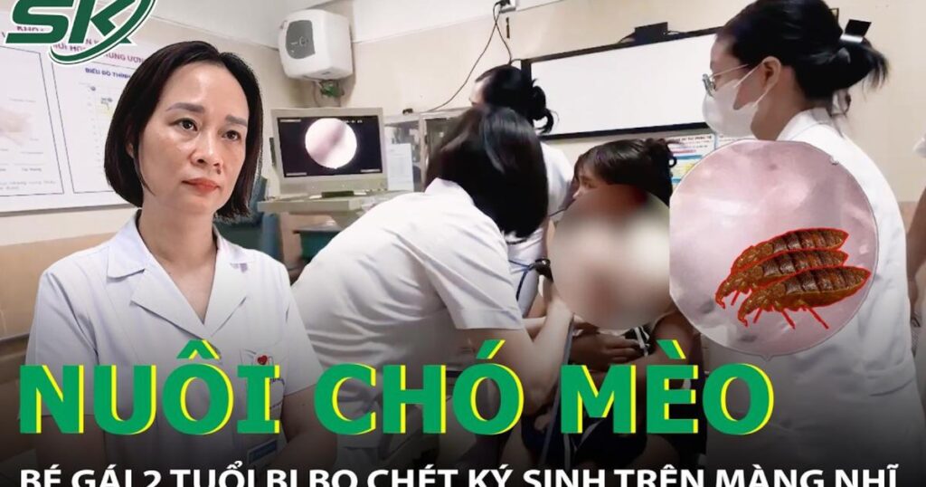 Nuôi chó mèo trong nhà, bé gái 2 tuổi bị bọ chét ký sinh trên màng nhĩ
