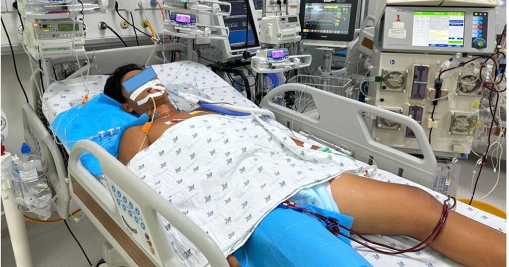 Đá bóng dưới trời nắng, bé trai sốc nhiệt biến chứng huỷ cơ, suy đa cơ quan