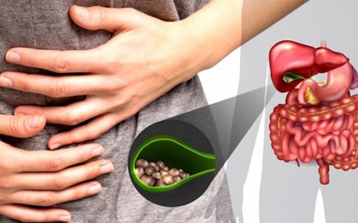 Tán sỏi qua da cho người đàn ông bị biến dạng cột sống 18 năm- Ảnh 4.