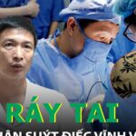 Tự lấy ráy tai tại nhà, bệnh nhân suýt điếc vĩnh viễn