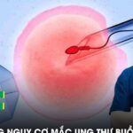 IVF có làm tăng nguy cơ mắc ung thư buồng trứng?