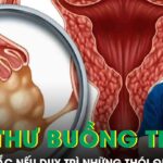 Phụ nữ dễ mắc ung thư buồng trứng nếu duy trì những thói quen này