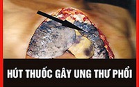 WHO: Cảnh báo trên bao bì thuốc lá là cách truyền thông hiệu quả, ít tốn kém