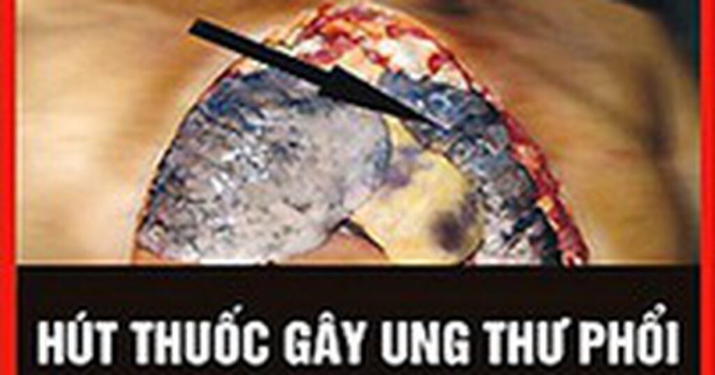 WHO: Cảnh báo trên bao bì thuốc lá là cách truyền thông hiệu quả, ít tốn kém