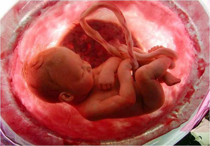 Giải mã cách ăn uống và vận động tác động lên gen ung thư- Ảnh 3.