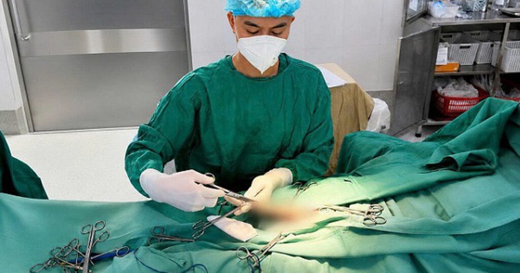 Cụ ông 74 tuổi mệt mỏi khi có ‘rổ sỏi’ lạo xạo trong bao quy đầu